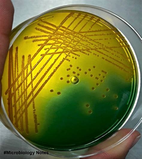 Vibrio Cholerae Owaga On Tcbs Agar Microbe Notes