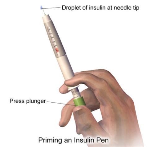 The Business Of Insulin Pumps In Diabetes Care