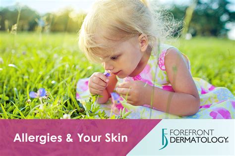 Allergies And Your Skin Forefront Dermatology
