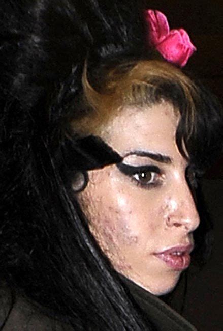 amy winehouse s lifestyle is taking its toll for her once fresh faced appearance amywinehouse