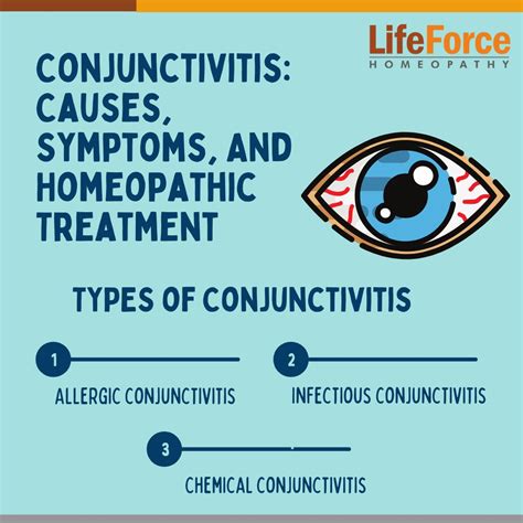 Conjunctivitis Causes Symptoms And Homeopathic Treatment