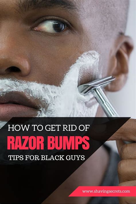 Saying Bye To The Bumps How To Get Rid Of Black Mens Razor Bumps