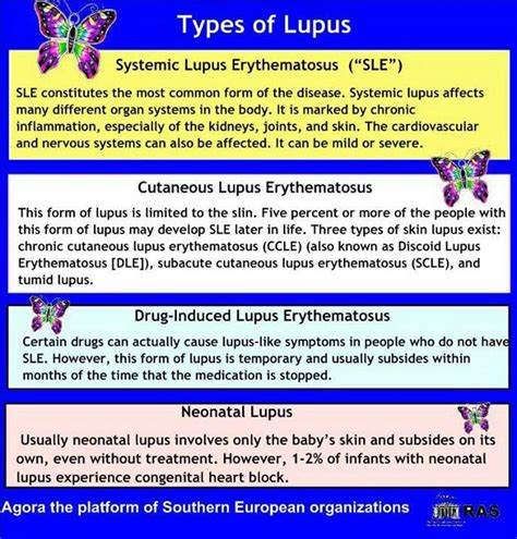 The Four Types Of Lupus