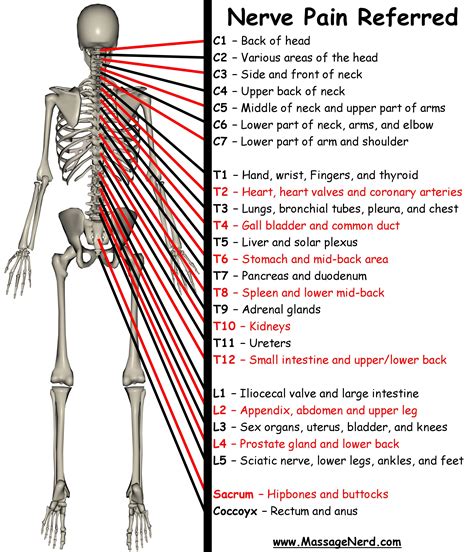 Referred Pain By Spinal Level Repinned By Sos Inc Resources
