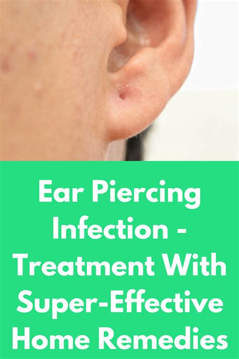 Old Ear Piercing Infection Antibiotics