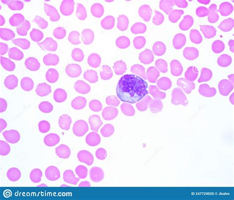 Human Blood Smear Monocyte Stock Photo Image Of Histology Smear