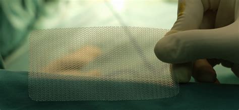 Nhs Agrees To Immediately Halt Use Of Surgical Mesh Following Review