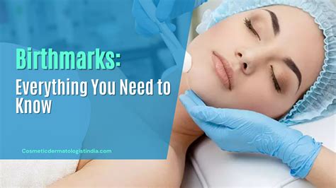 Birthmarks Everything You Need To Know Cosmetic Dermatologist India