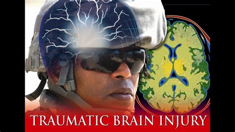 Posted by the live better team | september 16, 2016. Traumatic Brain Injury (documentary) - YouTube