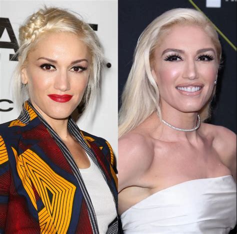 Did Gwen Stefani Ever Go Through Plastic Surgery Check The Singers