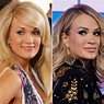 Did Carrie Underwood Get Plastic Surgery? Photos Then, Now