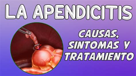 La Apendicitis Causas S Ntomas Diagn Stico Y Tratamiento Youtube