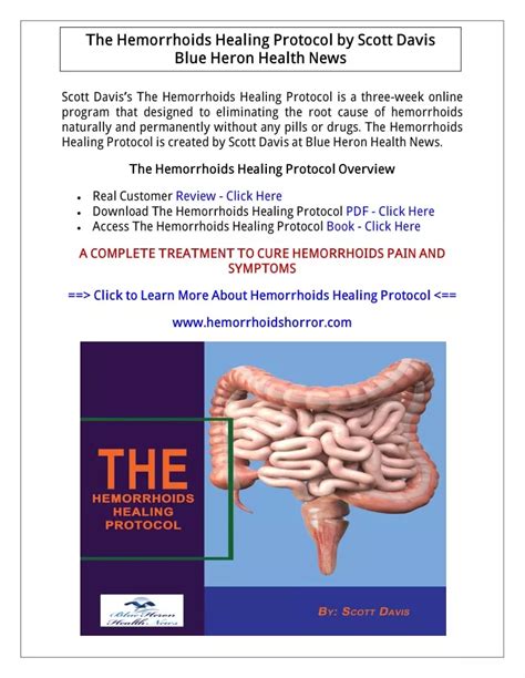 Ppt Pdf The Hemorrhoids Healing Protocol Book Pdf Download Scott