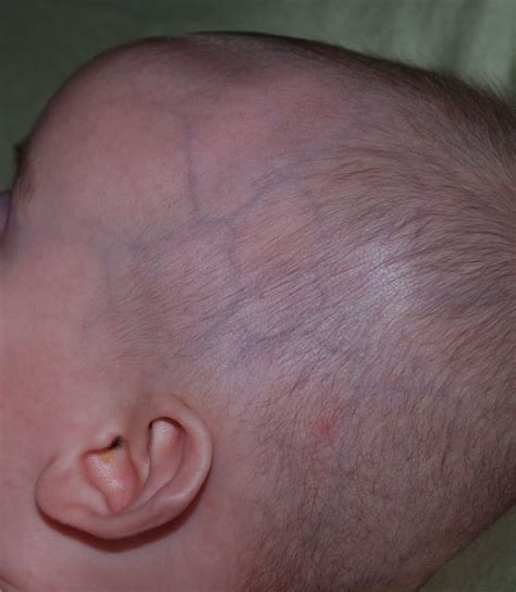 Image Result For Newborn Baby Veins On Head Reborn Dolls Reborn