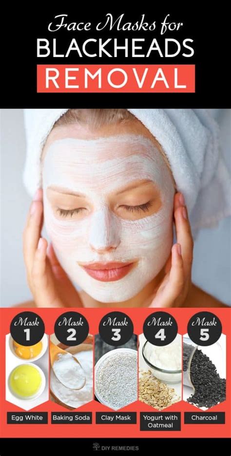 5 Best Face Masks For Blackheads Removal
