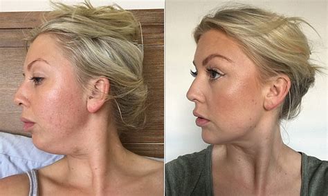 How One Woman Finally Got Rid Of Her Double Chin Daily Mail Online