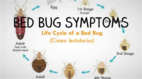 Beg Bug Symptoms 5 Signs You Have Bed Bugs Youtube