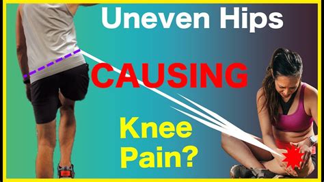 Uneven Hips Causing Knee Pain Case Report Youtube