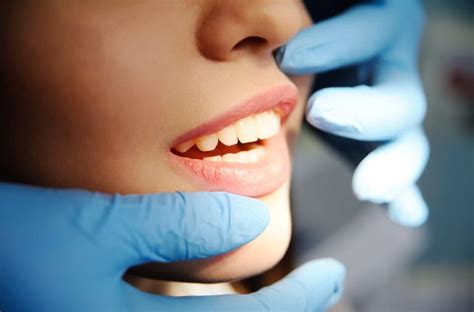 Northside Dental Clinic Pros And Cons Of Ceramic Fillings