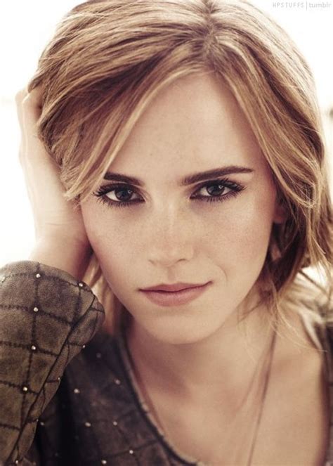 Emma Watson Freckles Girl Beauty Emma Watson
