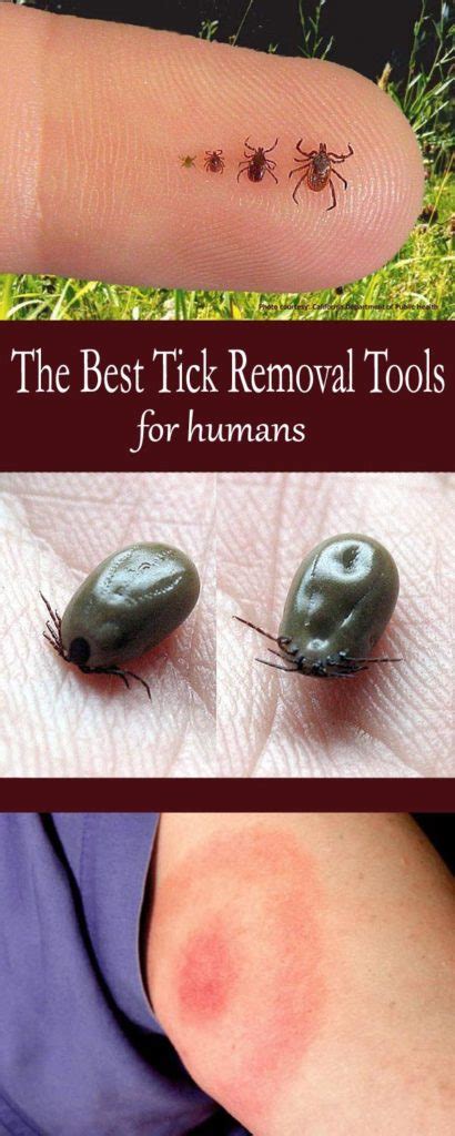 The Best Tick Removal Tools For Humans Mom Goes Camping