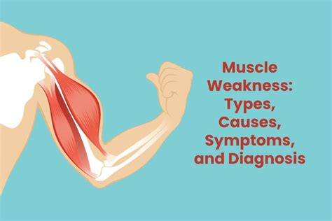 Muscle Weakness 12 Causes And More Tabitomo