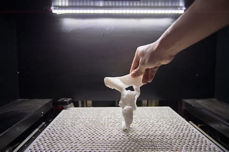 The Potential Of 3d Printing In Orthopedics Open World Learning