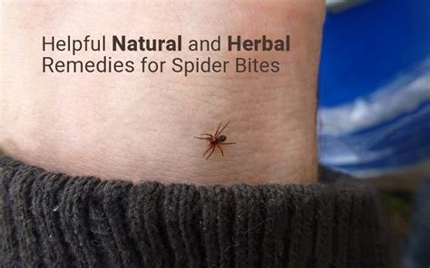 Natural And Herbal Remedies For Spider Bites
