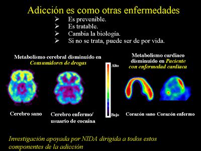 BLOG REYNA MEDINA EL CEREBRO ADICTO