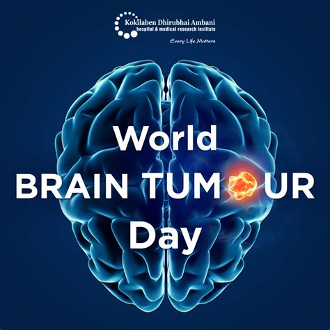 World Brain Tumor Day Health Tips From Kokilaben Hospital
