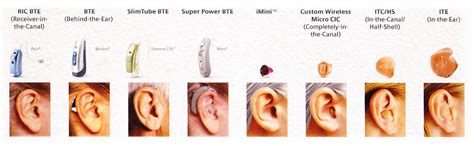 Hearing Doctors And Audiologists Philadelphia