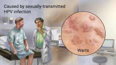 Qut Medical Centre Genital Warts