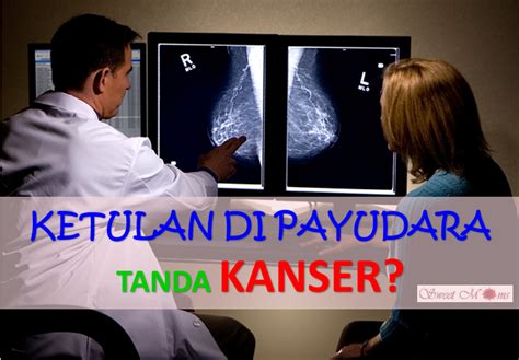 Kanser payudara adalah merupakan penyebab yang utama kematian pesakit kanser di kalangan para wanita di malaysia. Ketulan Di Payudara Tanda Kanser? 5 Jenis Ketulan Di ...