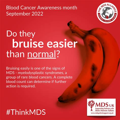 Blood Cancer Awareness Month Bruising Thinkmds Mds Uk Patient