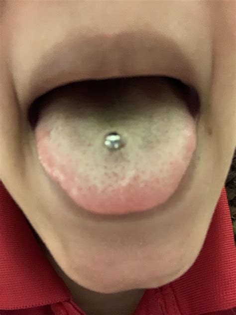 is my tongue piercing infected piercing