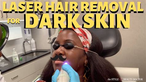 Getting Laser Hair Removal On Dark Skin Cutera 1064 Laser Youtube