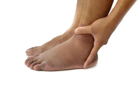 What Is A Peroneal Tendon Tear Phoenix Foot And Ankle Institute Foot