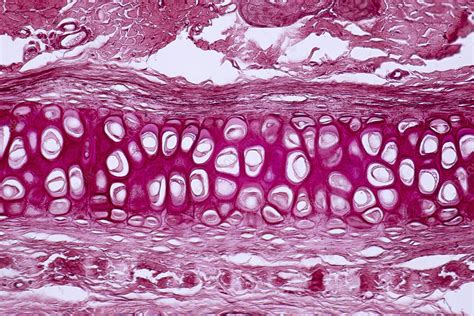 Human Cartilage And Bone Light Micrograph Stock Image F0323218