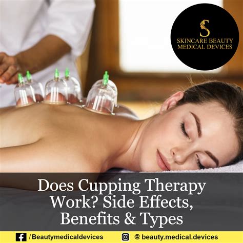 Does Cupping Therapy Work Side Effects Benefits Types