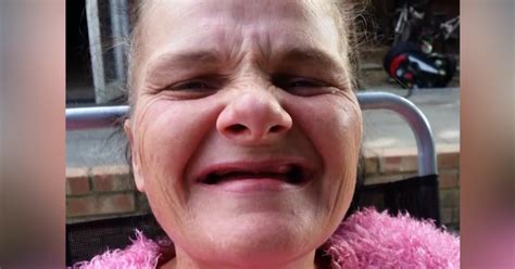 amazing transformation of grandmother who lost her teeth to a mouth tumour but won a new smile