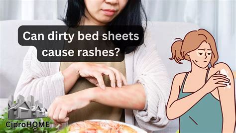 Can Dirty Bed Sheets Cause Rashes 2024