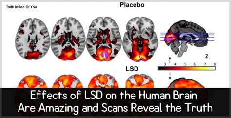 Effects Of Lsd On The Human Brain Are Trippy And Scans Reveal The Truth
