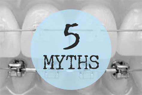 5 Myths About Braces And Orthodontic Treatment Orthodontist Vancouver