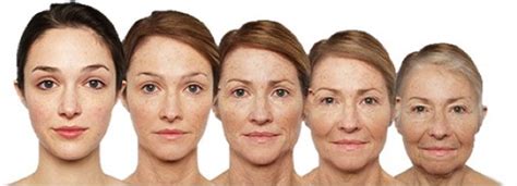 Facial Aging Dr Dirk Lazarus Plastic Surgeon