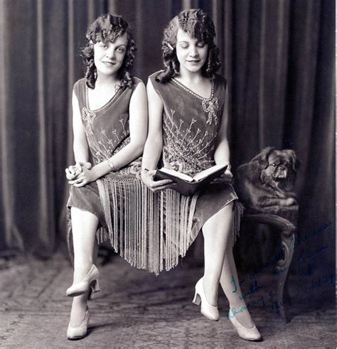 Conjoined Twins Daisy And Violet Hilton Late 1920s Oldschoolcool