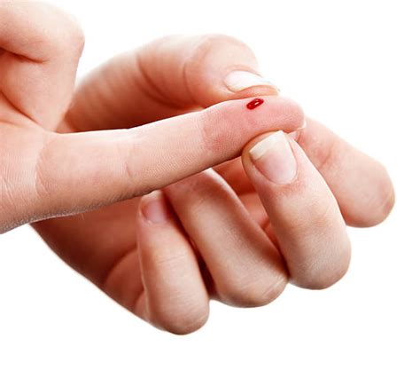 Bloody Finger Stock Photos Pictures And Royalty Free Images Istock