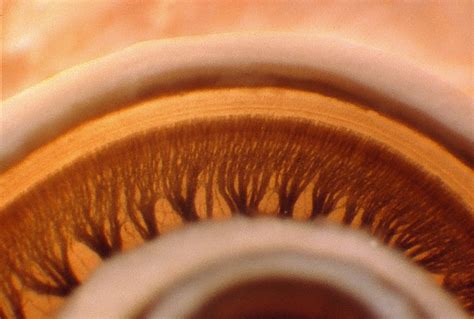 Why Structure Preservation Of The Cochlea Is So Important The Med El Blog