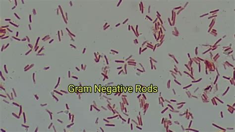 Gram Negative Rods Bacilli Of Klebsiella Pneumoniae Under The