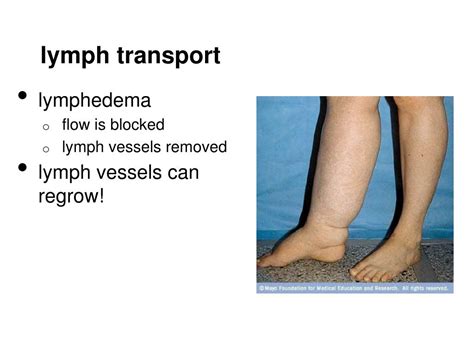 Ppt The Lymph System And Lymphoid Organs And Tissues Powerpoint