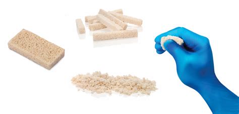 4 Common Types Of Bone Graft Materials Biogennix